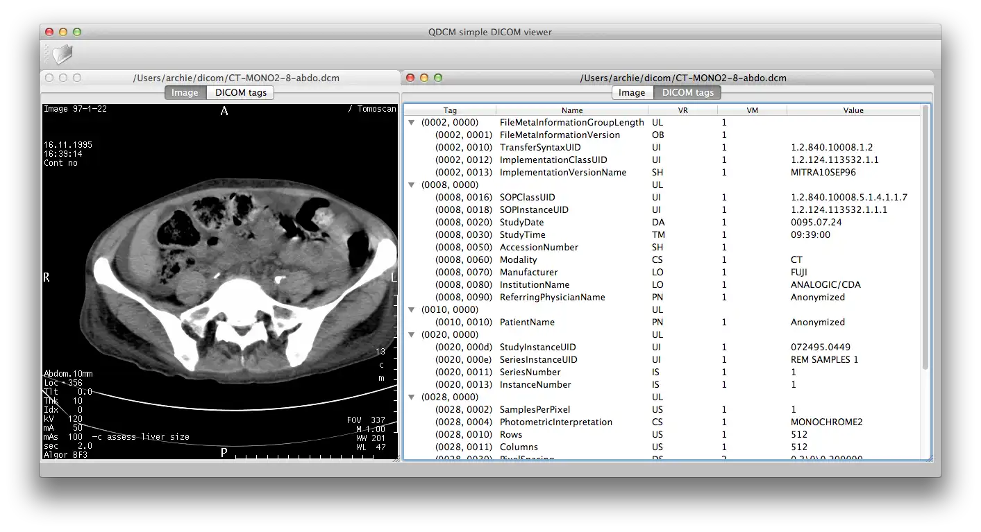 Download web tool or web app QDCM