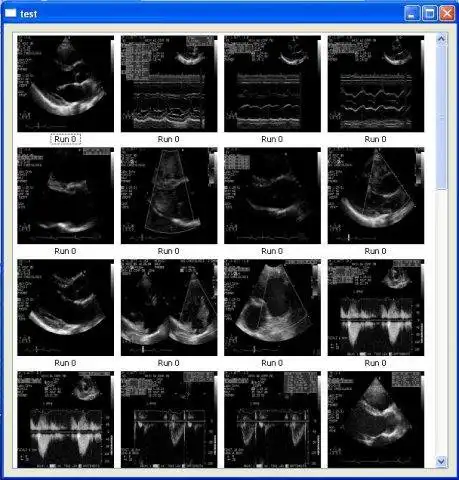 Download web tool or web app Qt4 Dicom Widget set to run in Linux online