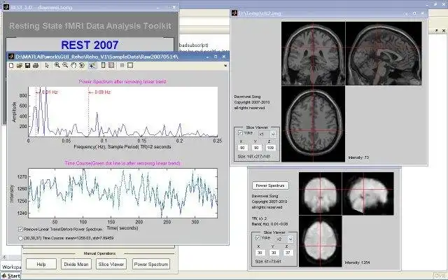 Download web tool or web app Resting state fMRI data analysis toolkit