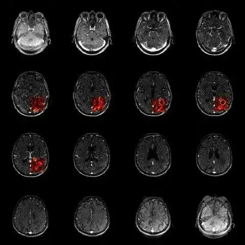Download web tool or web app R Package for the Analysis of DCE-MRI