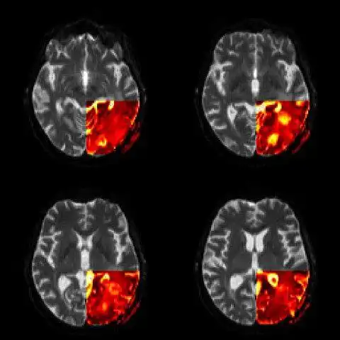 Download web tool or web app R Package for the Analysis of DCE-MRI to run in Windows online over Linux online