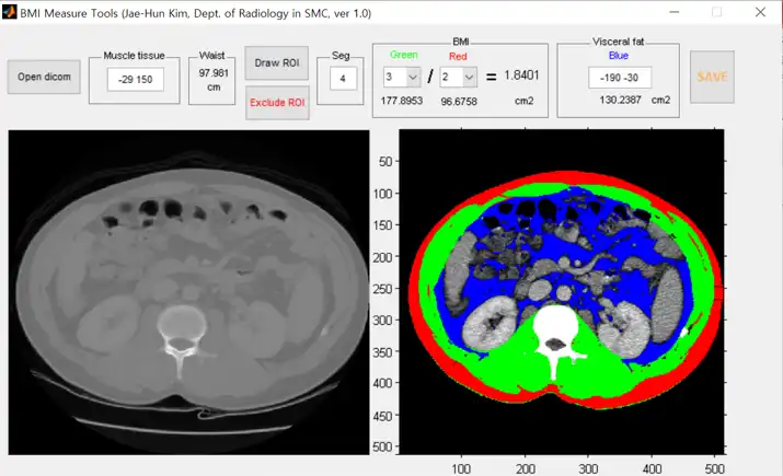 تنزيل أداة الويب أو تطبيق الويب أداة القياس شبه التلقائي (BMI_CT)