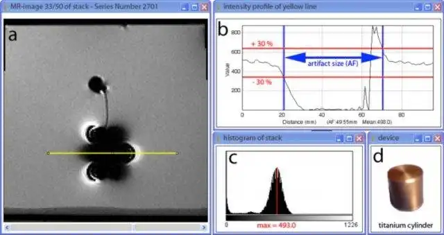 Download web tool or web app Susceptibility Artefact Measurement