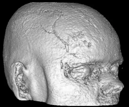 Descărcați instrumentul web sau aplicația web V3D-Viewer